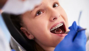 cuándo poner ortodoncia (brackets) en niños