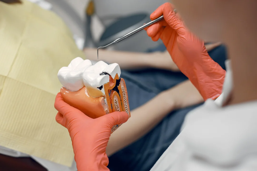 Precio del tratamiento de conducto o endodoncia en Venezuela